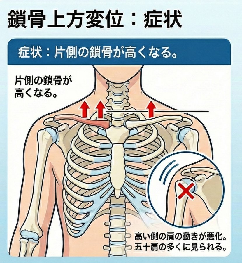 肩の問題と鎖骨の関係